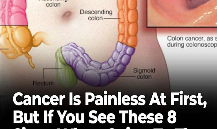 How Your Bowel Movements Reveal Clues About Colon Cancer